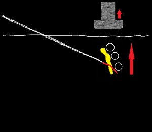 Catheter Position after Probe Removed despite NO Needle Movement!