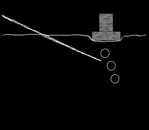 Probe and Needle Orientation