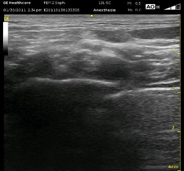 _wsb_359x333_supraclav