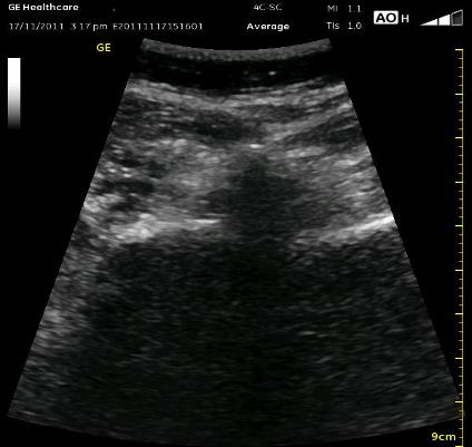 _wsb_424x401_midline+w+sp+$26+facets+1