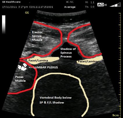 _wsb_424x407_midline+w+sp+$26+facets+3