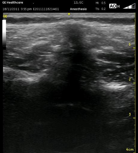 _wsb_460x513_LP+midline