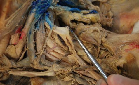 _wsb_476x291_BR+PL+15