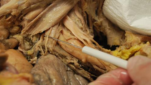 _wsb_496x278_BR+PL+20